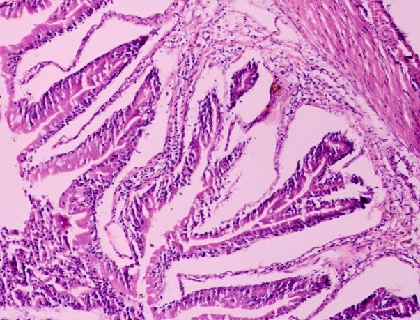 Intestine of Clarias batrachus fed with Natural feed (NATFO, F7) showing normal architecture of intestine with circular muscles, longitudinal muscles, serosa and villi. H/E X 125