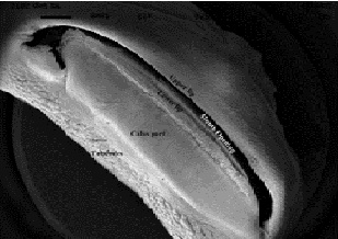 Fig: Surface electron microphotograph (SEMPH) of the ventral side of lip epidermis of S. richardsonii showing well developed tubercles on adhesive pad of posterior lip (Scale bar- 01 m).