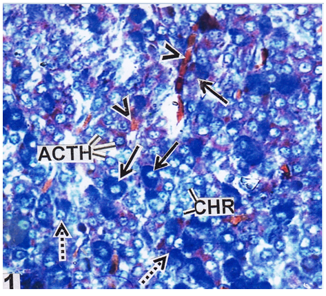 Fig: RPD region of pituitary gland during growth phase showing the distribution of GTH cells (solid arrows), TSH cells (broken arrows), ACTH cells and chromophobe cells (CHR). Note blood vessels (arrow heads) in between pituitary cells; (AB-OFG) × 400X.